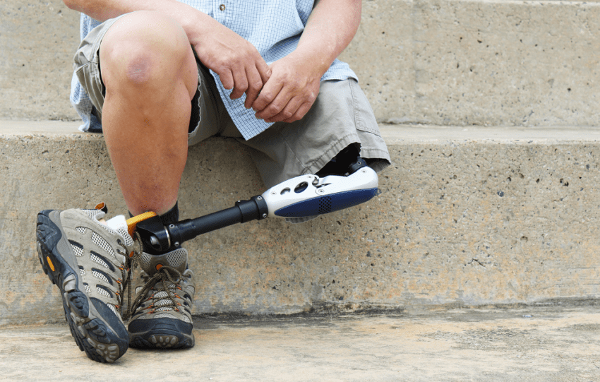 image of an artificial leg on a person setting on steps