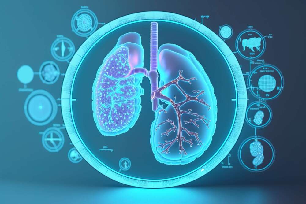 Image of a kidney scan